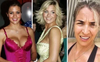 Gemma Atkinson Boob Job