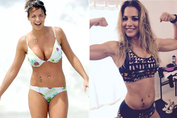 Gemma Atkinson Cosmetic Surgery Body