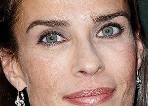 Kristian Alfonso Plastic Surgery