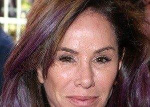 Melissa Rivers Plastic Surgery