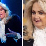 Bonnie Tyler Cosmetic Surgery