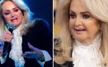 Bonnie Tyler Cosmetic Surgery