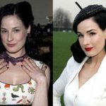 Dita Von Teese Plastic Surgery