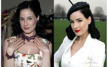 Dita Von Teese Plastic Surgery